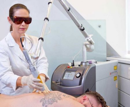 Tattooentfernung mit Laser die attraktivste Behandlungsmethode